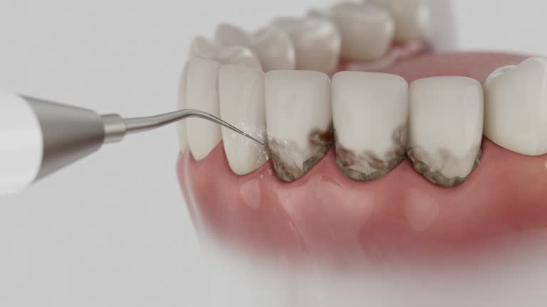 Reliable Dental contractor in Summer Set, MO by Smile Center Dentistry
